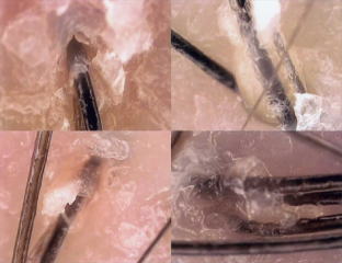 �ь����ӂ̉ߏ�Ȕ玉